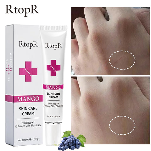Mango Skin Care Cream